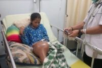 Pasien Penderita Penyakit Tumor yang di rawat di Rumah Sakit Umum (RSUP) Dr. Johannes Laimena. Foto Mn/RW.