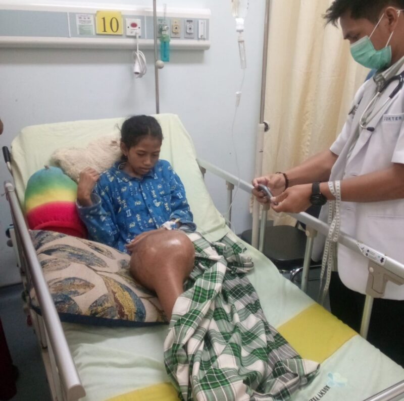 Pasien Penderita Penyakit Tumor yang di rawat di Rumah Sakit Umum (RSUP) Dr. Johannes Laimena. Foto Mn/RW.